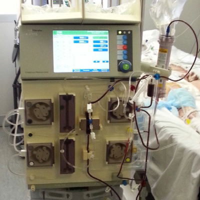 Продленная гемодиафильтрация